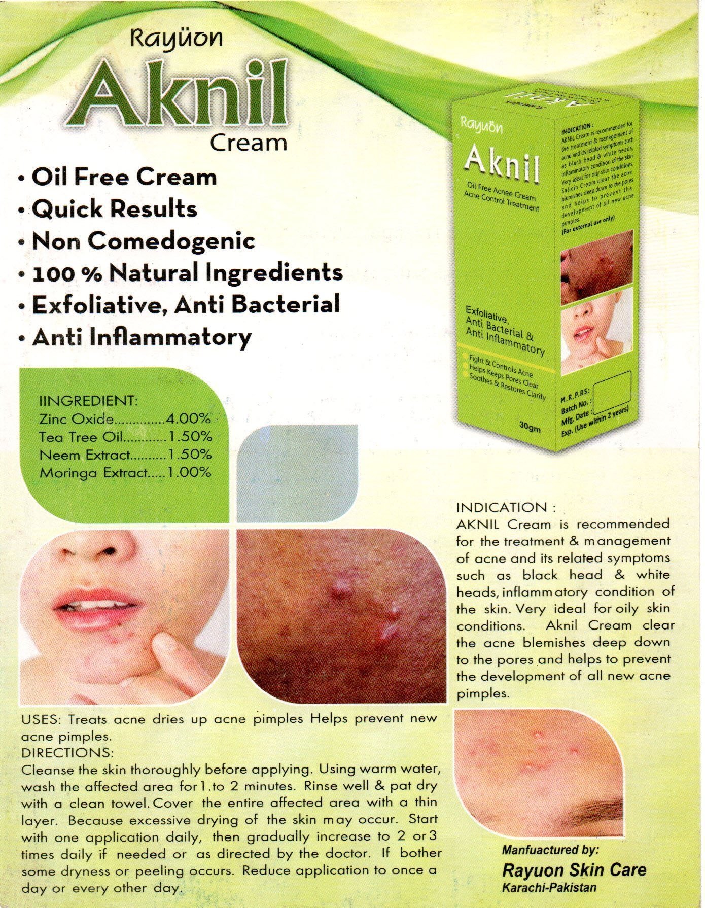 Rayuon Skincare Aknil Cream (30gm) Oil-Free Acne Control Treatment