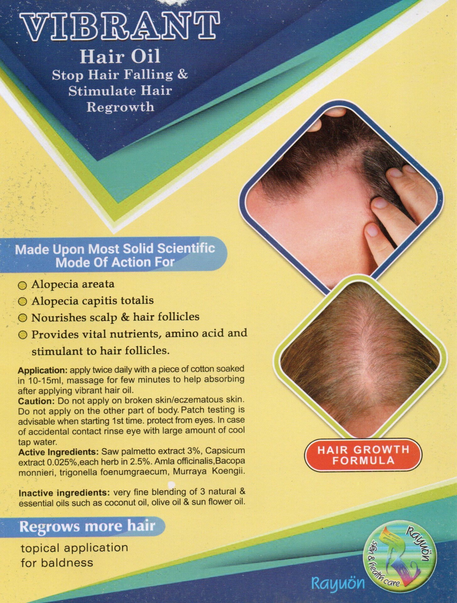 Rayuon Skincare Vibrant Hair Oil (100ml) Stop Hair Falling & Stimulate Hair Regrowth