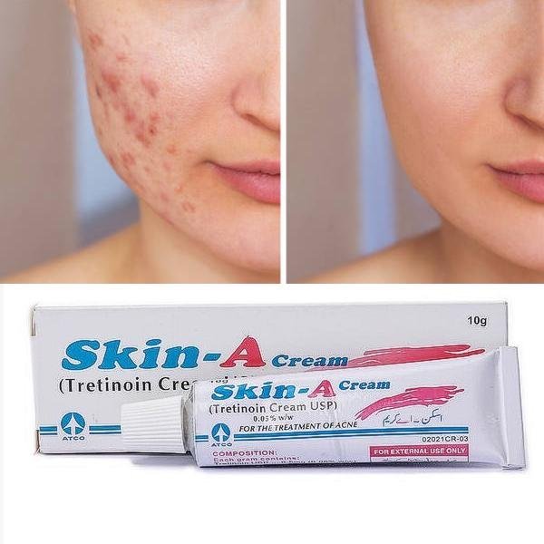 Skin A Cream Tretinoin Cream For Clear Acne Free